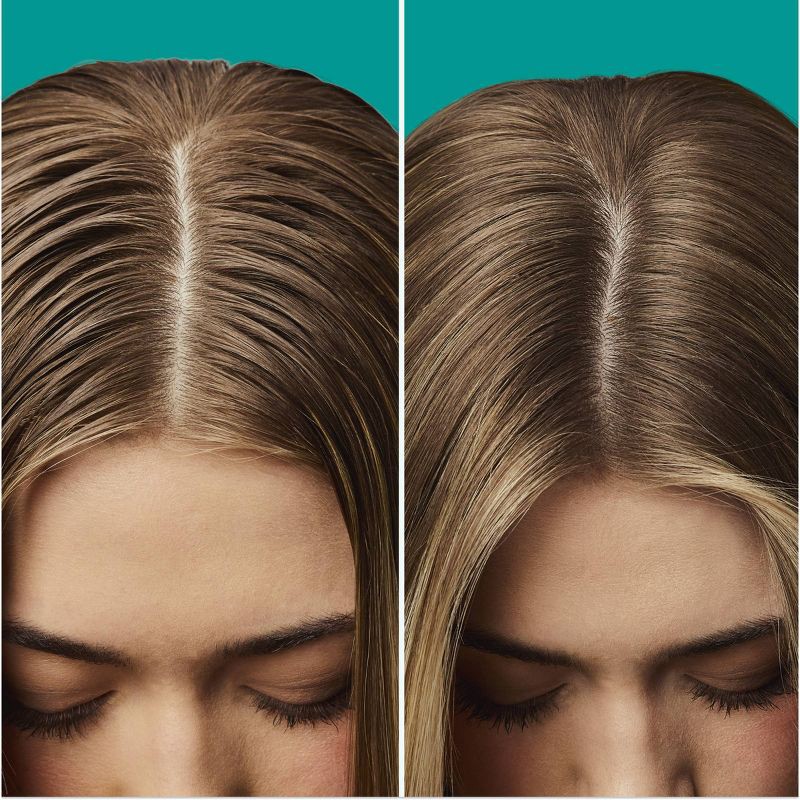 slide 2 of 10, Batiste Original Dry Shampoo - 5.71oz, 5.71 oz