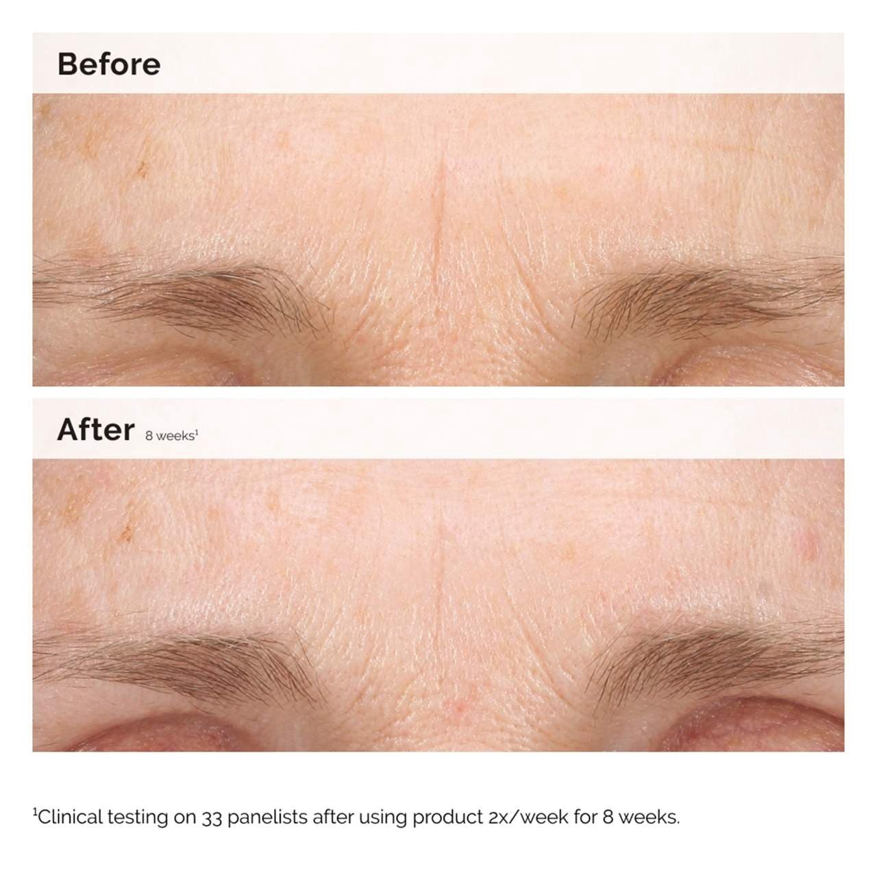 slide 2 of 10, The Ordinary Retinal 0.2% Emulsion High-Strength Retinoid Nighttime Treatment 0.5 oz / 15 ml,