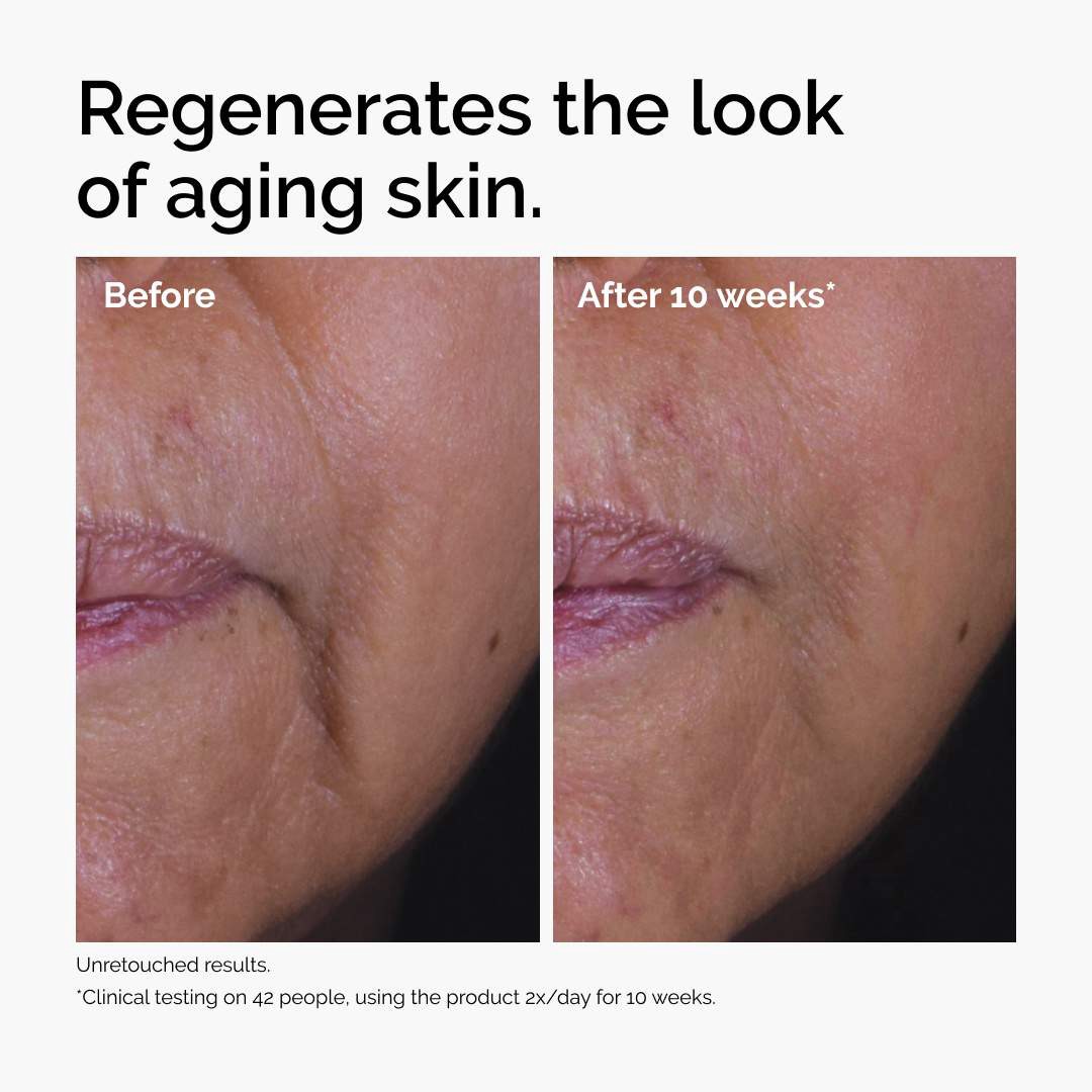 slide 4 of 7, The Ordinary GF 15% Serum for Visible Skin Repair and Wrinkles 1 oz / 30 mL, 