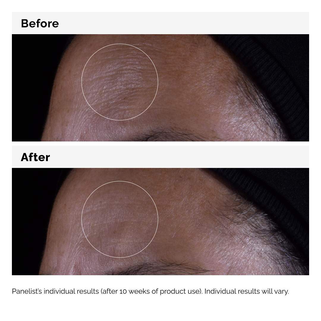 slide 5 of 7, The Ordinary GF 15% Serum for Visible Skin Repair and Wrinkles 1 oz / 30 mL, 