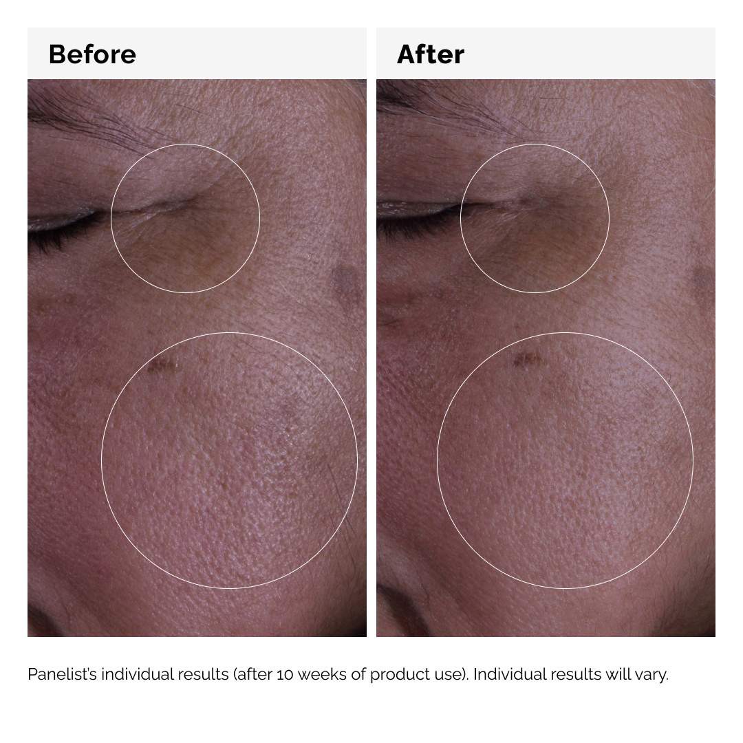 slide 6 of 7, The Ordinary GF 15% Serum for Visible Skin Repair and Wrinkles 1 oz / 30 mL, 