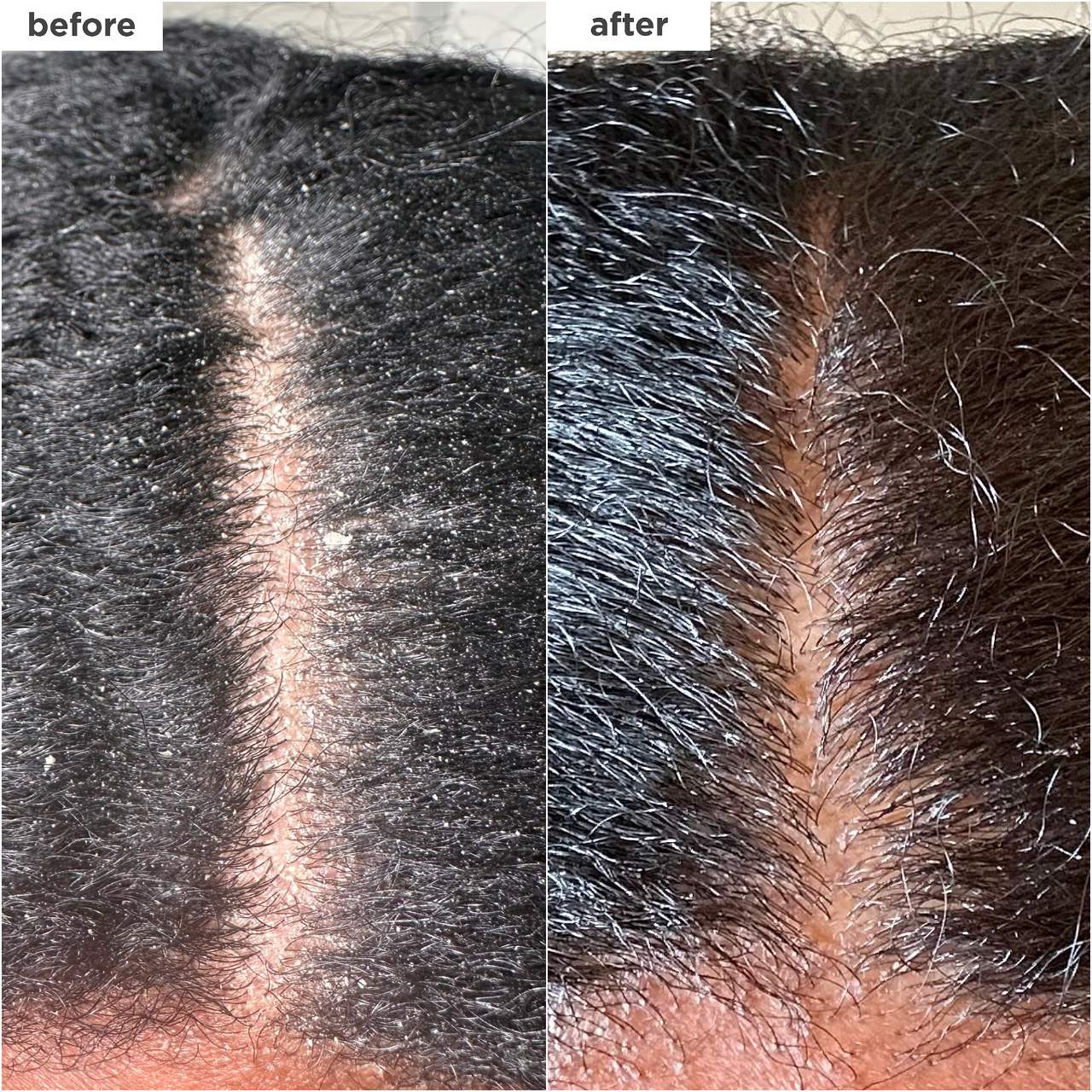 slide 2 of 8, Briogeo Scalp Revival™ Dandruff Relief Charcoal Shampoo 8.4 oz/ 248 mL,