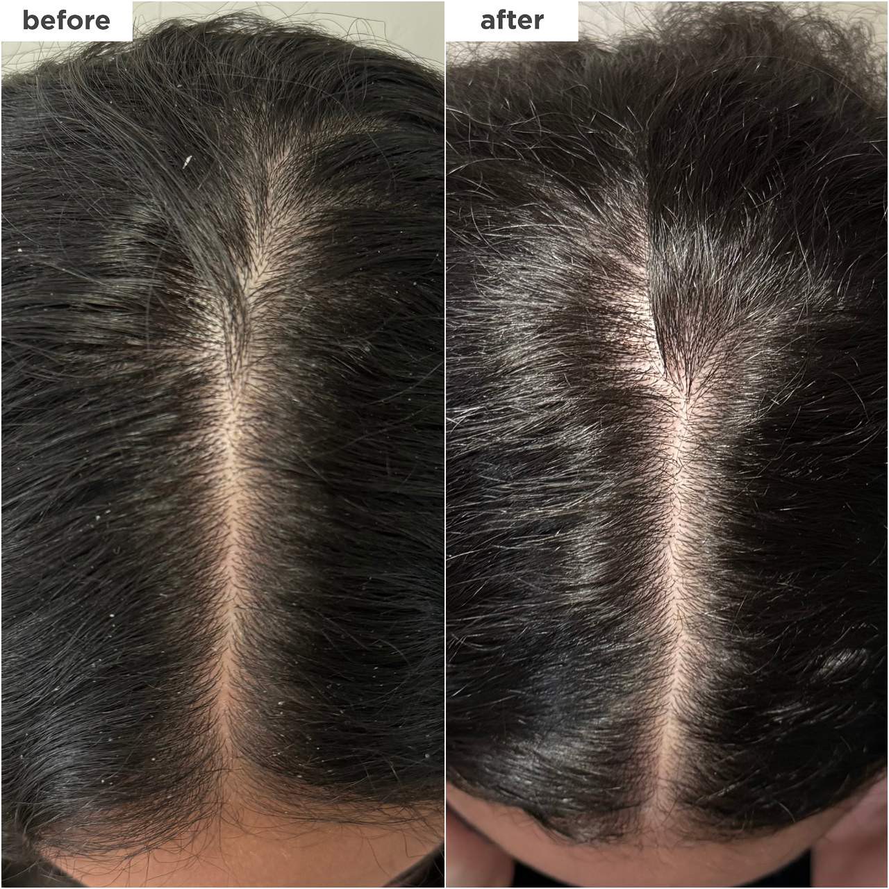 slide 3 of 8, Briogeo Scalp Revival™ Dandruff Relief Charcoal Shampoo 8.4 oz/ 248 mL,