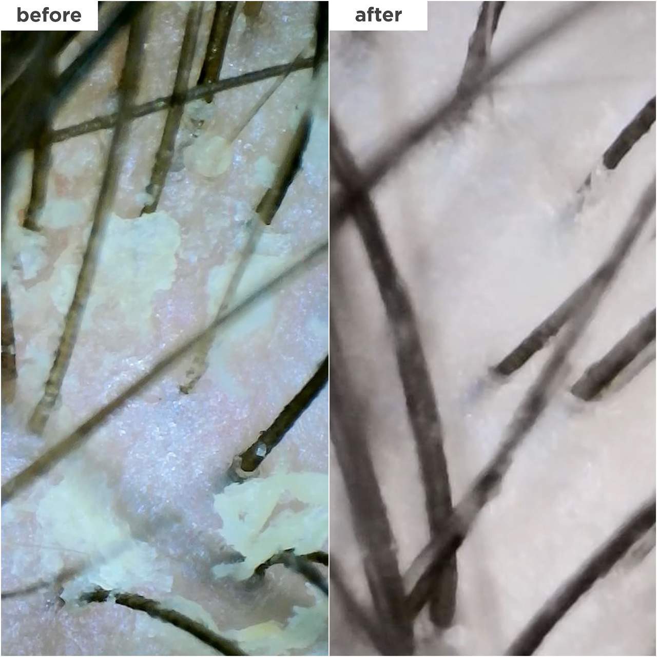 slide 5 of 8, Briogeo Scalp Revival™ Dandruff Relief Charcoal Shampoo 8.4 oz/ 248 mL,