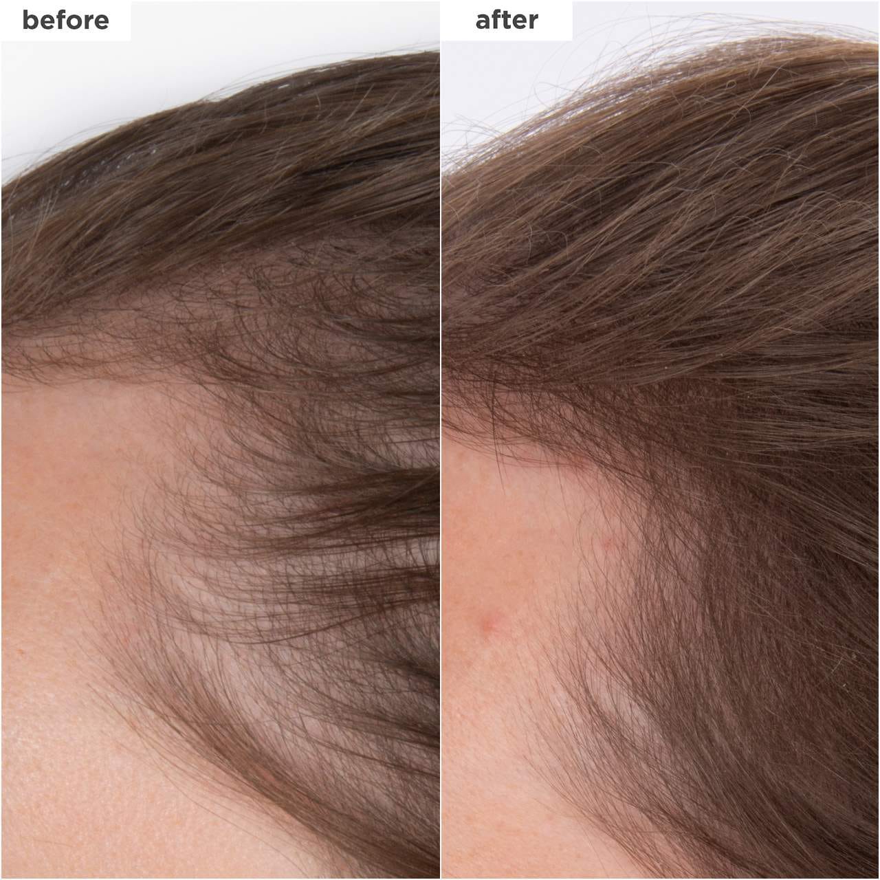 slide 3 of 9, Briogeo Destined for Density™ Peptide Hair Serum for Thicker, Fuller Hair 1.5 oz / 45 mL, 