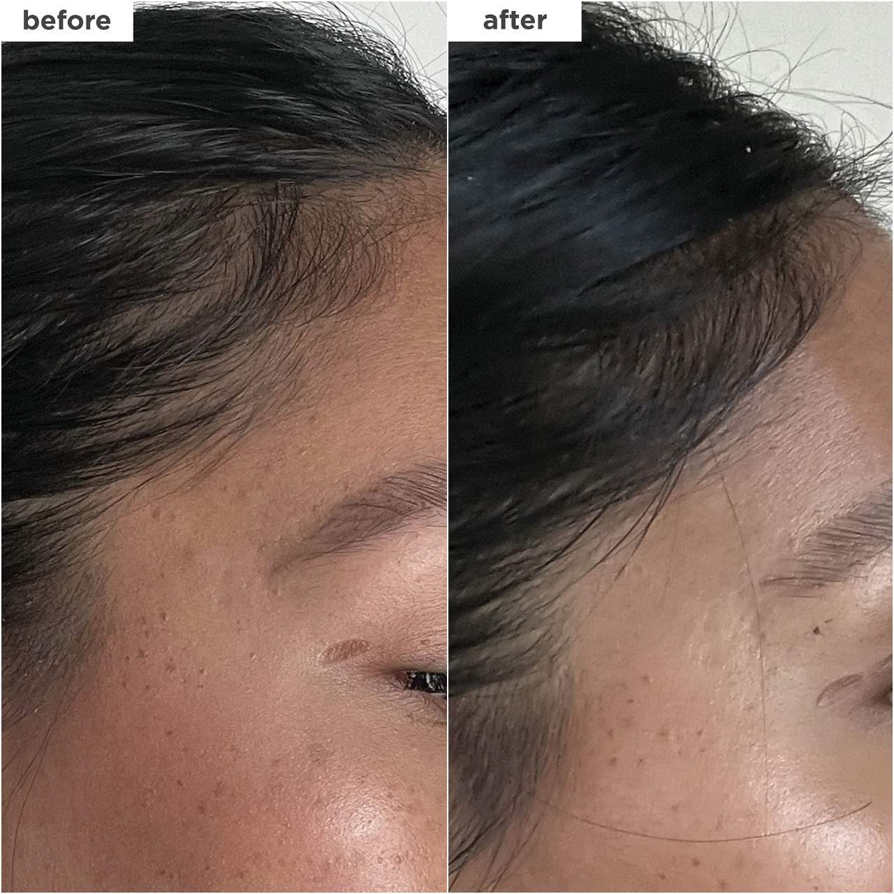 slide 5 of 9, Briogeo Destined for Density™ Peptide Hair Serum for Thicker, Fuller Hair 1.5 oz / 45 mL, 