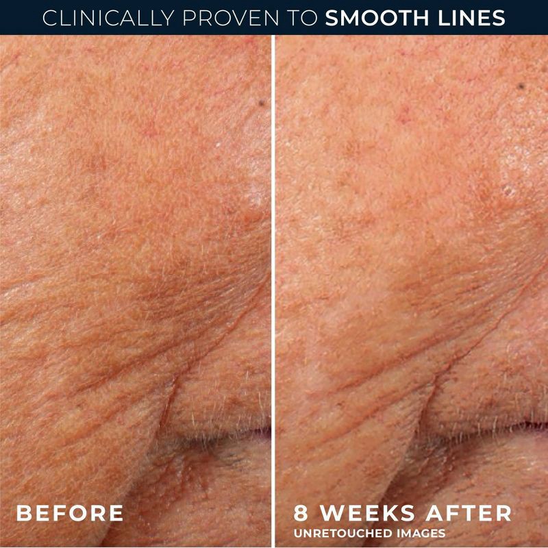 slide 6 of 10, RoC Retinol Capsules Anti-Aging Night Retinol Face Serum Treatment - 30ct/0.35 fl oz, 30 ct, 0.35 fl oz