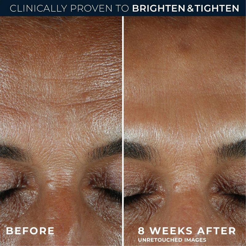 slide 5 of 9, RoC Brightening Anti-Aging Serum with Vitamin C for Dark Spots - 1.0 fl oz, 1 fl oz