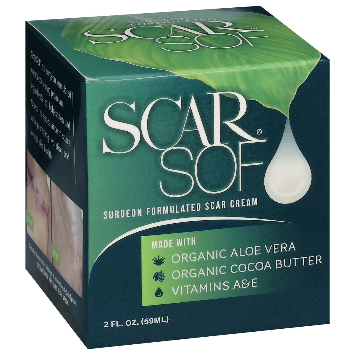 slide 5 of 12, Scar Sof Jar, 2 oz