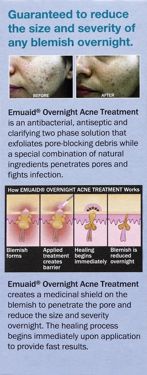 slide 4 of 4, Emuaid Acne Treatment 1 oz, 1 oz