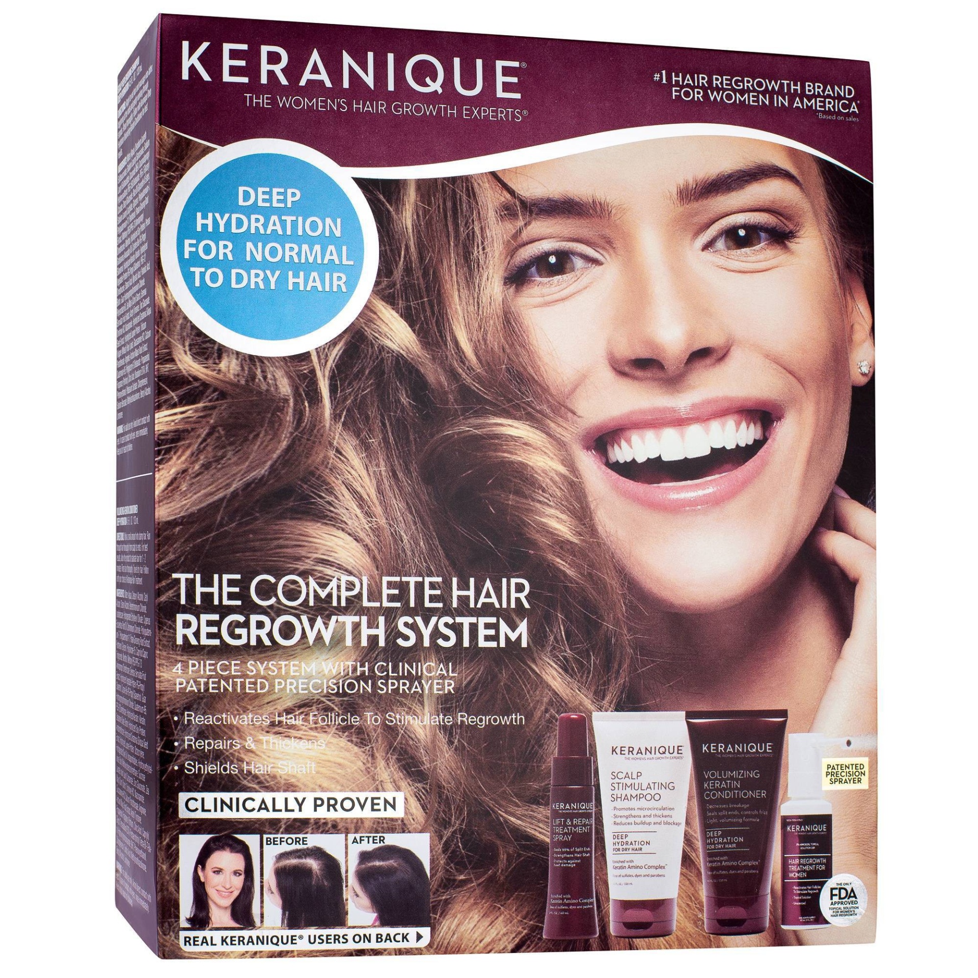 Keranique The Complete Hair Regrowth System 1 ct Shipt