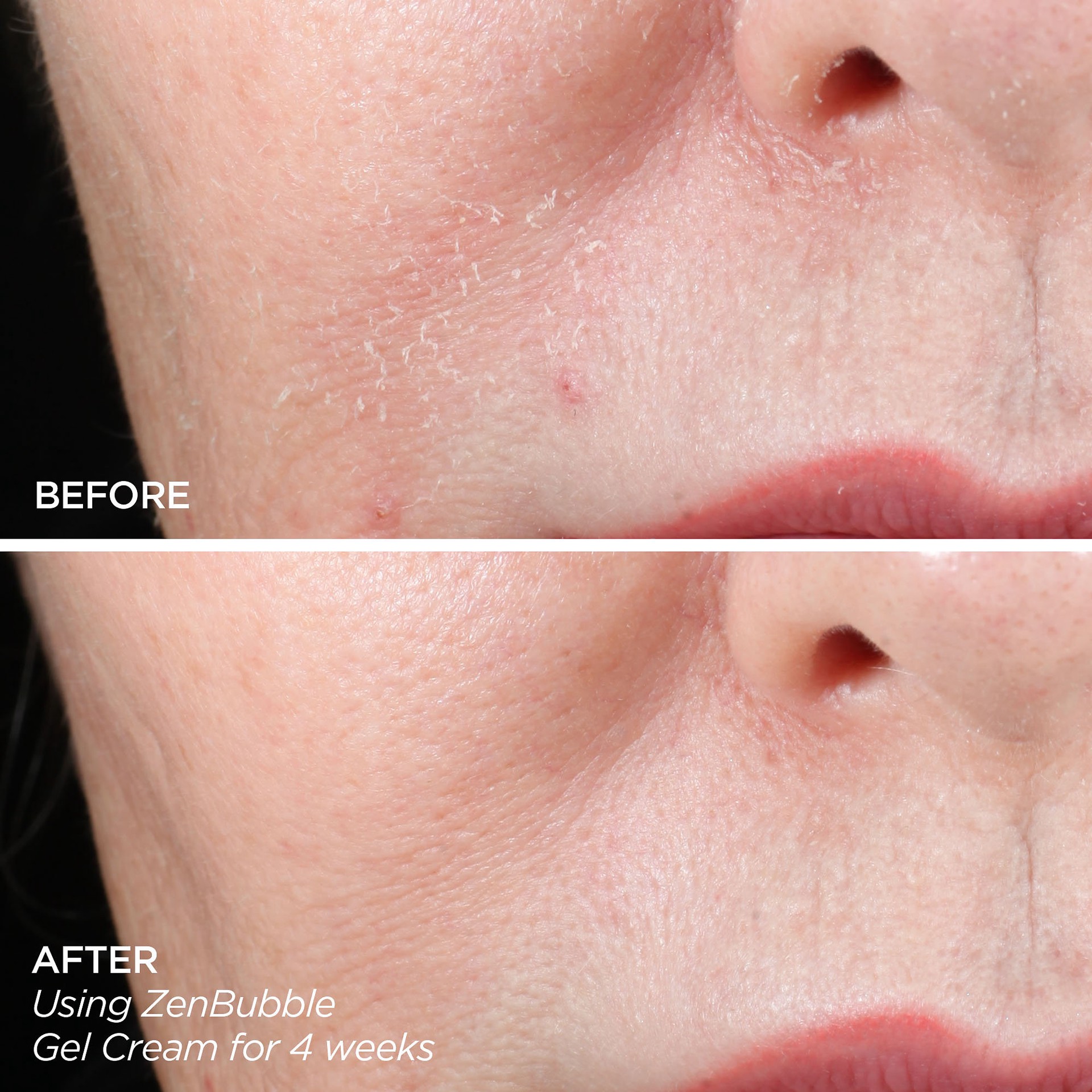 slide 3 of 8, BeautyBio Get That Glow - GloPRO® Microneedling Tool & Discovery Set, 1 ct