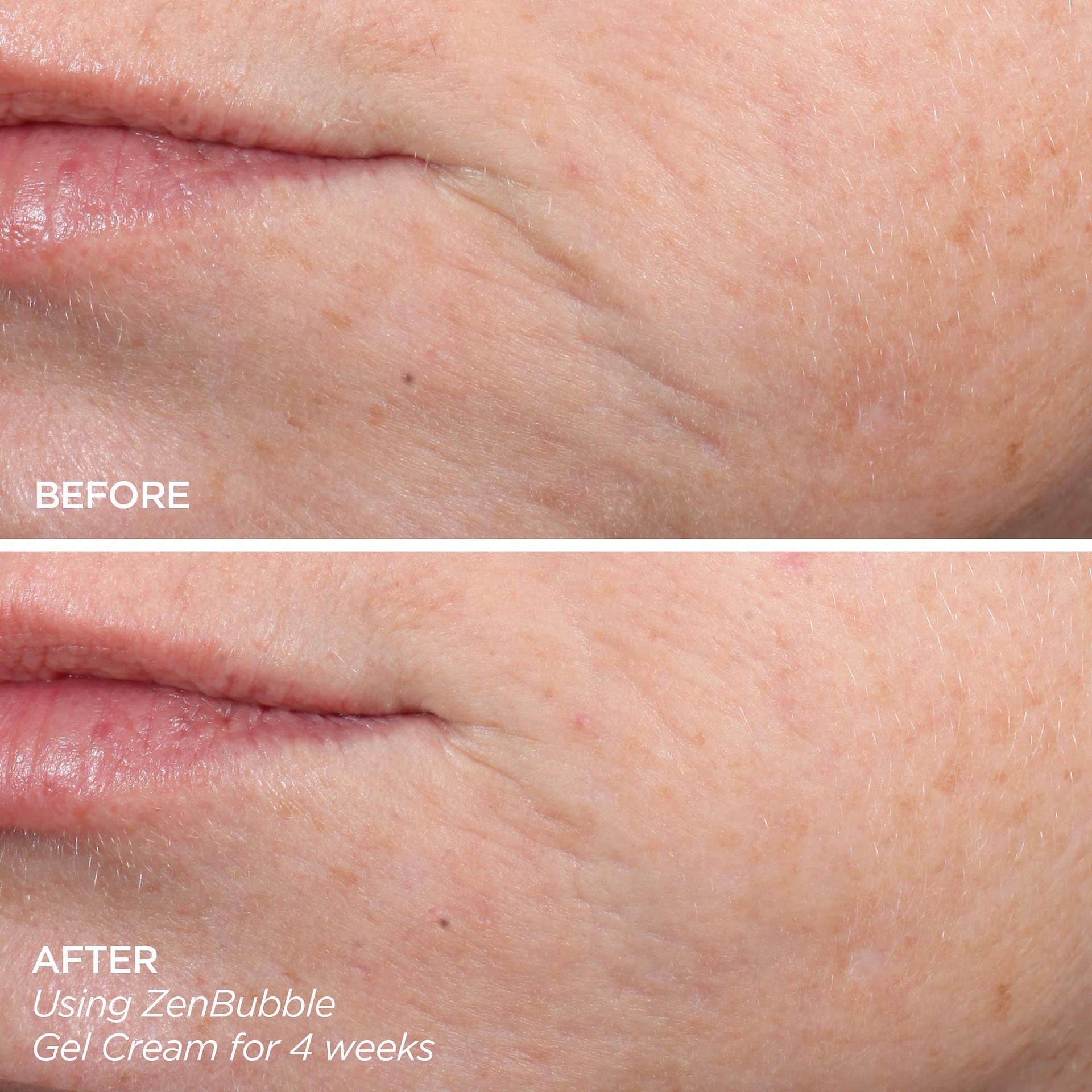 slide 5 of 8, BeautyBio Get That Glow - GloPRO® Microneedling Tool & Discovery Set, 1 ct
