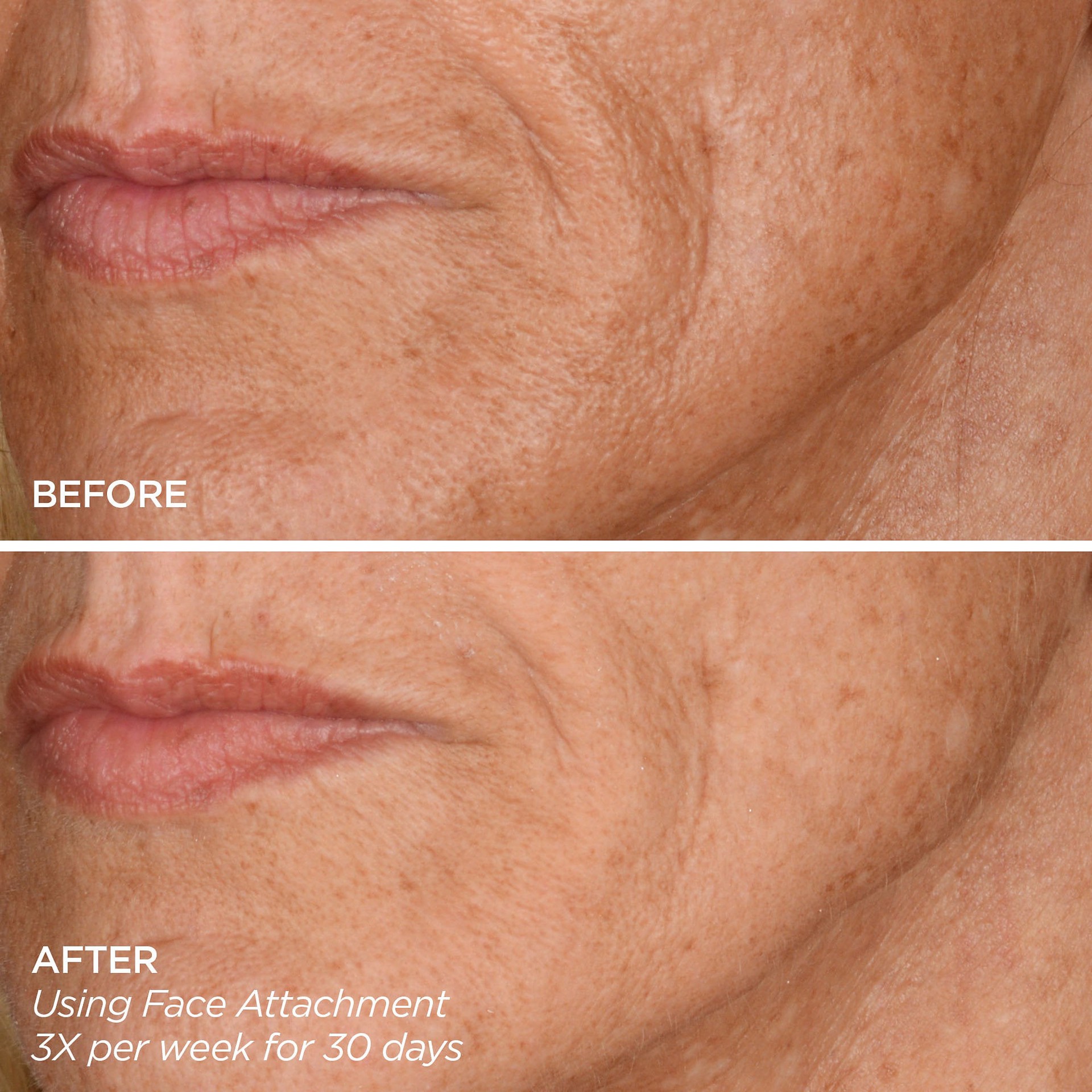 slide 6 of 8, BeautyBio Get That Glow - GloPRO® Microneedling Tool & Discovery Set, 1 ct