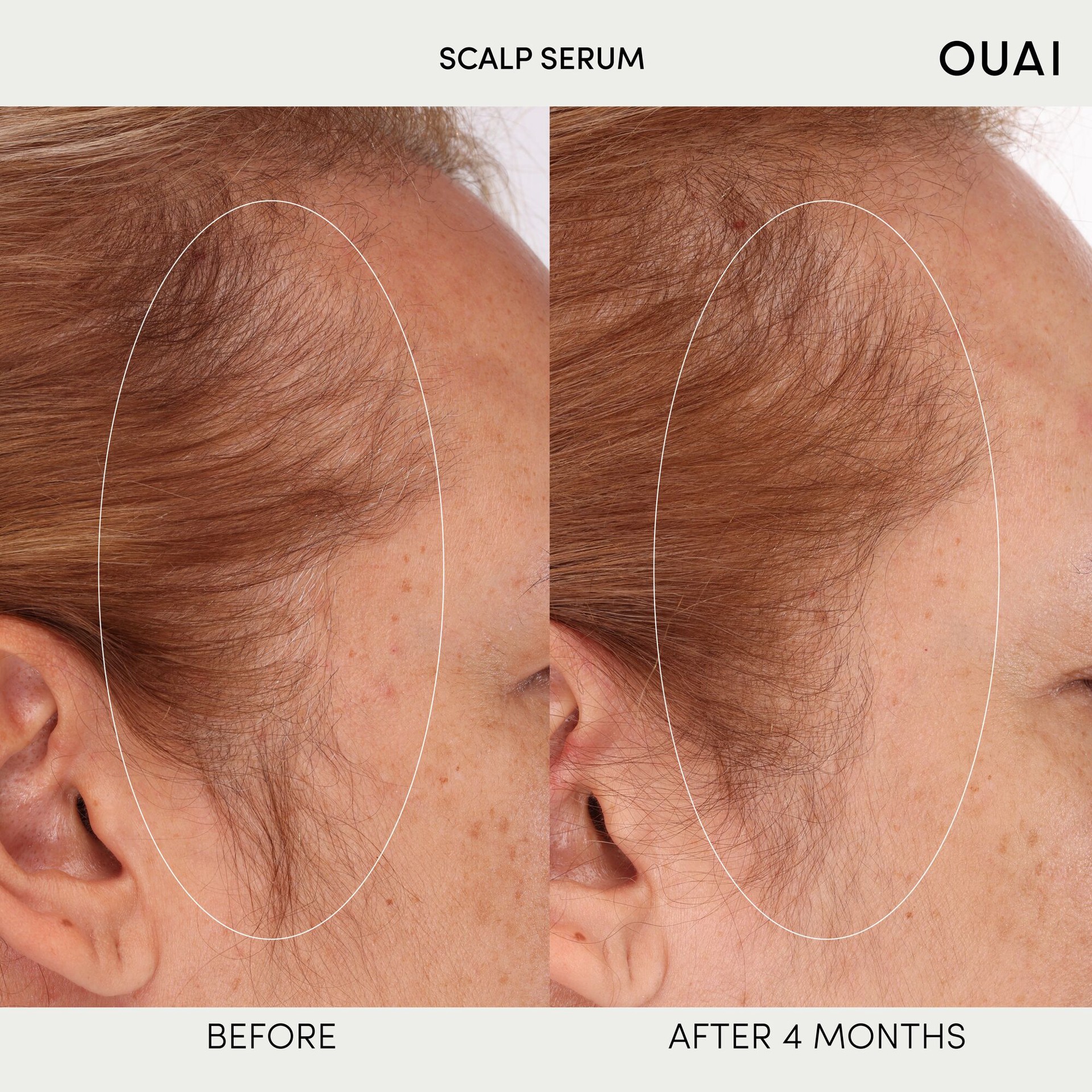 slide 2 of 6, OUAI Hydrating Scalp Serum for Healthy, Fuller Looking Hair 2 oz / 60 mL, 