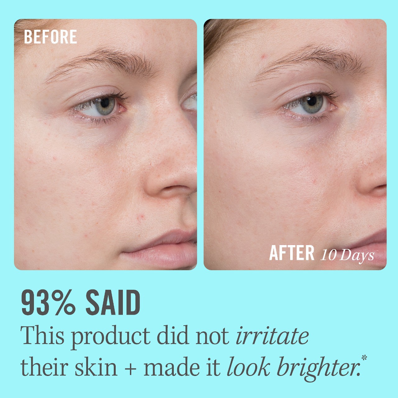 slide 6 of 9, First Aid Beauty 10% Vitamin C Brightening Serum 1.7 oz / 50 mL,