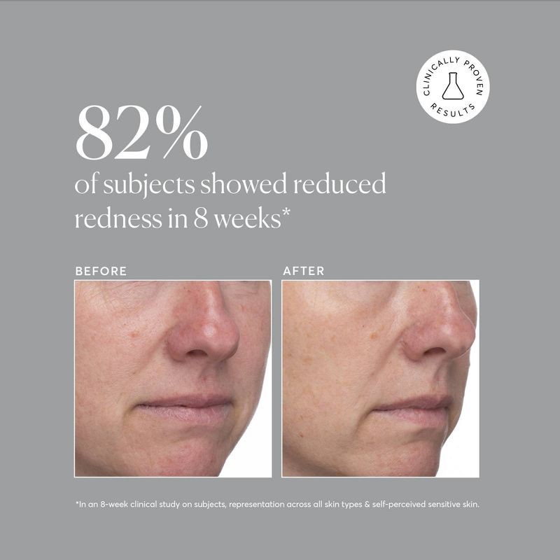 slide 7 of 8, Naturium Azelaic Topical Acid 10% - 1 fl oz, 1 fl oz