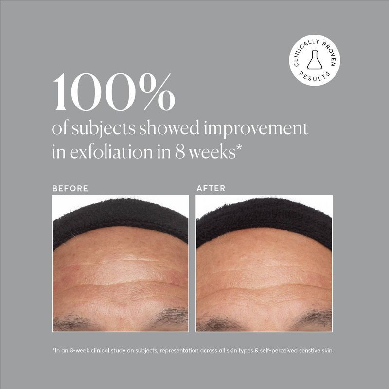 slide 8 of 8, Naturium Azelaic Topical Acid 10% - 1 fl oz, 1 fl oz