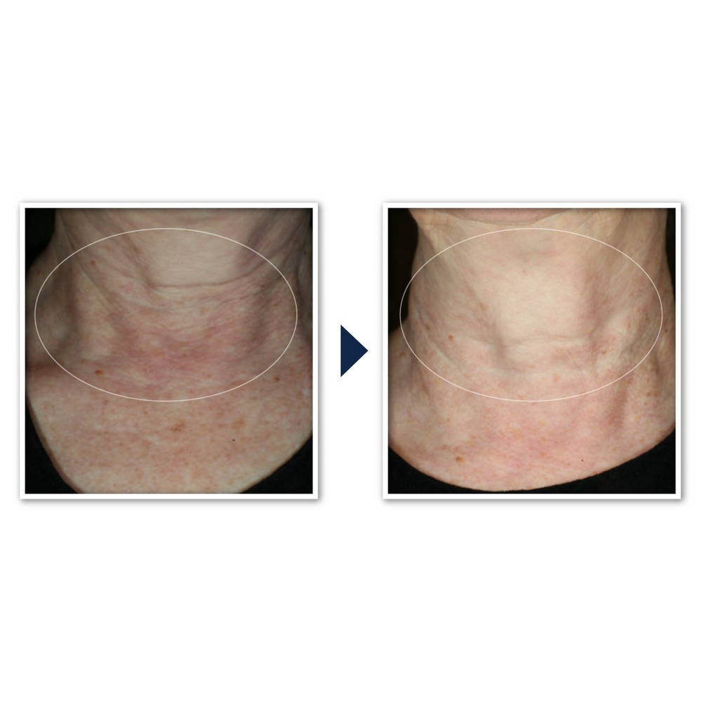 slide 3 of 12, RoC Face & Neck Anti-Aging Moisturizer Firming Cream for Crepey Skin - 1.7 fl oz, 1.7 fl oz