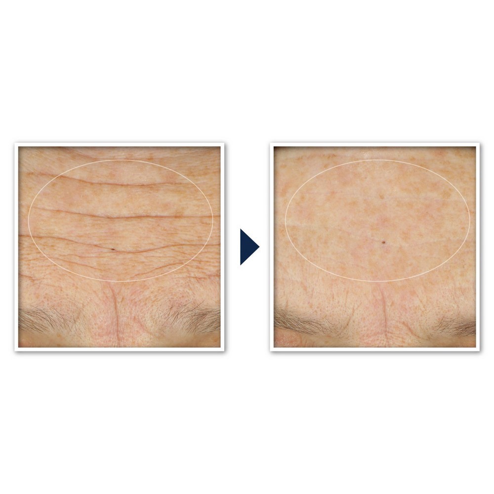 slide 5 of 12, RoC Face & Neck Anti-Aging Moisturizer Firming Cream for Crepey Skin - 1.7 fl oz, 1.7 fl oz