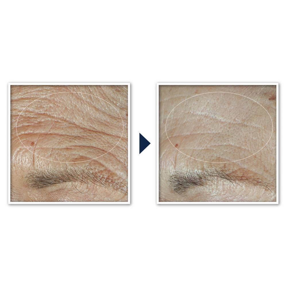 slide 6 of 12, RoC Face & Neck Anti-Aging Moisturizer Firming Cream for Crepey Skin - 1.7 fl oz, 1.7 fl oz