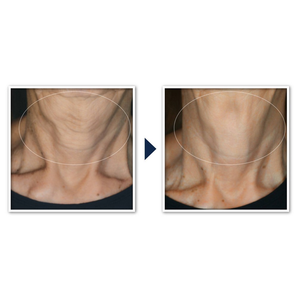 slide 12 of 12, RoC Face & Neck Anti-Aging Moisturizer Firming Cream for Crepey Skin - 1.7 fl oz, 1.7 fl oz