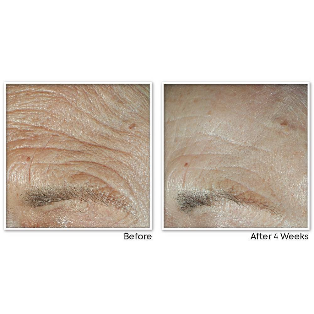 slide 7 of 12, RoC Face & Neck Anti-Aging Moisturizer Firming Cream for Crepey Skin - 1.7 fl oz, 1.7 fl oz