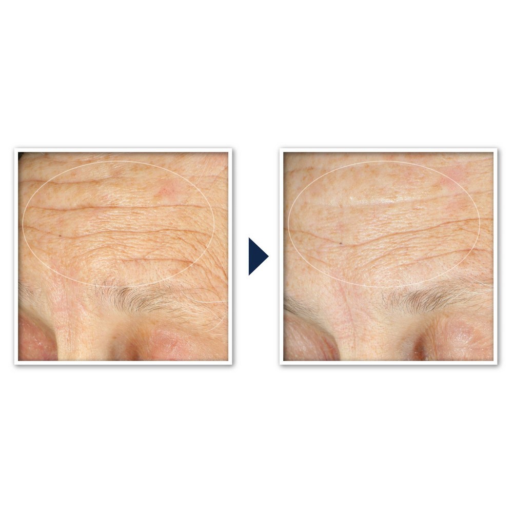 slide 4 of 12, RoC Face & Neck Anti-Aging Moisturizer Firming Cream for Crepey Skin - 1.7 fl oz, 1.7 fl oz