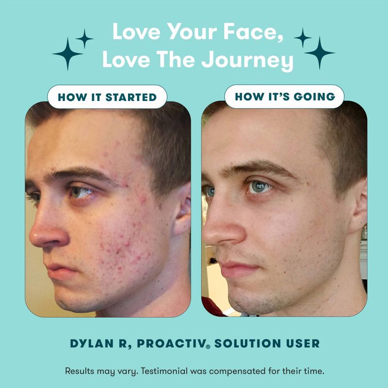 slide 7 of 8, Proactiv Solution 30 Day Acne Treatment Kit - 5 fl oz/3pc, 5 fl oz, 3 ct
