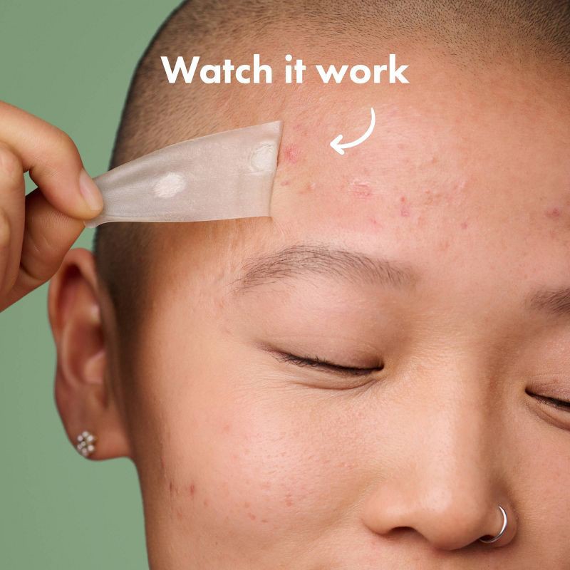 slide 4 of 8, Hero Cosmetics Hero Mighty Patch Surface - 10ct, 10 ct