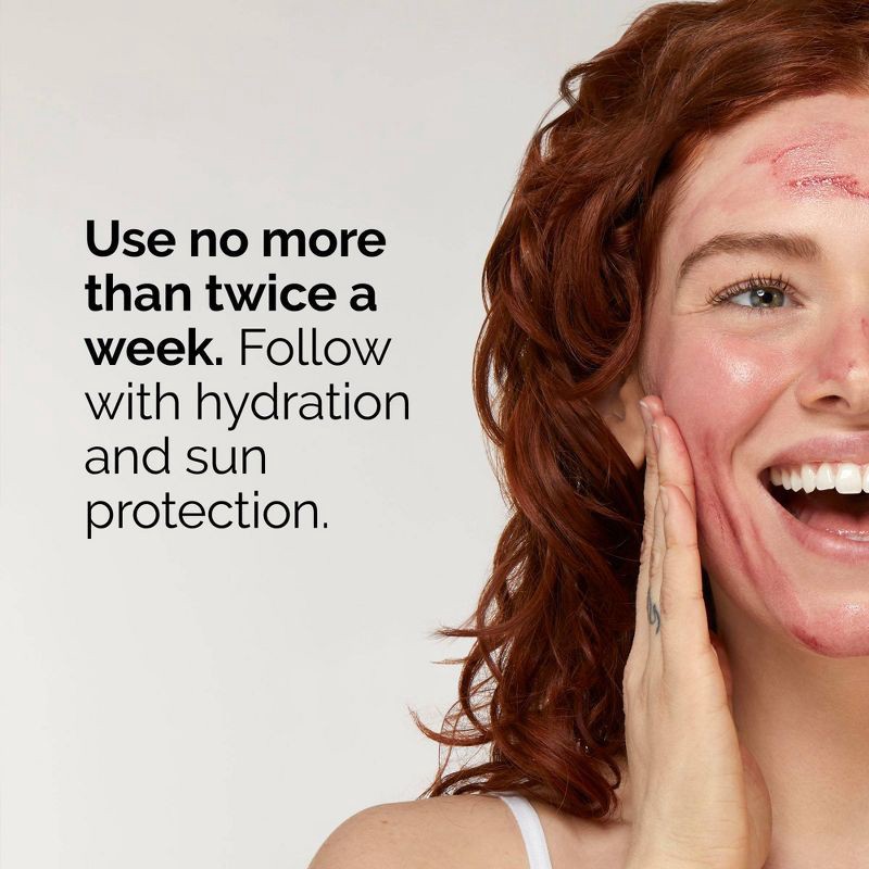 slide 5 of 7, The Ordinary AHA 30% + BHA 2% High-Strength Peeling Solution for Brightening - 1 fl oz - Ulta Beauty, 1 fl oz