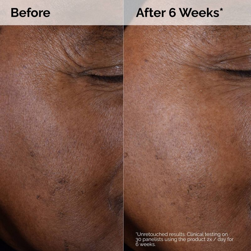 slide 4 of 8, The Ordinary Glycolic Acid 7% Exfoliating and Brightening Daily Toner - 8 fl oz - Ulta Beauty, 8 fl oz