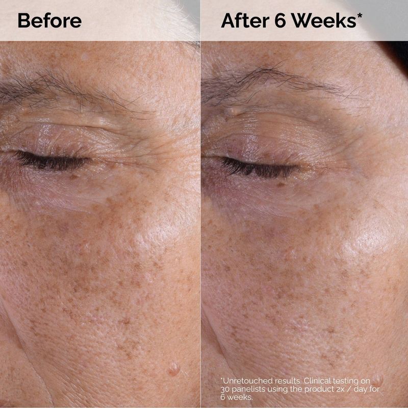 slide 5 of 8, The Ordinary Glycolic Acid 7% Exfoliating and Brightening Daily Toner - 8 fl oz - Ulta Beauty, 8 fl oz