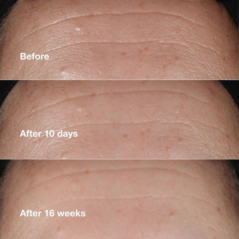 slide 5 of 9, Clinique Smart Clinical Repair Wrinkle Correcting Serum - 1 fl oz - Ulta Beauty, 1 fl oz