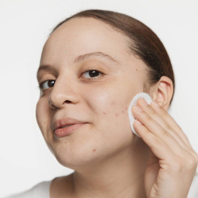 slide 2 of 6, Clinique Acne Solutions Clarifying Lotion - 6.7 fl oz - Ulta Beauty, 6.7 fl oz