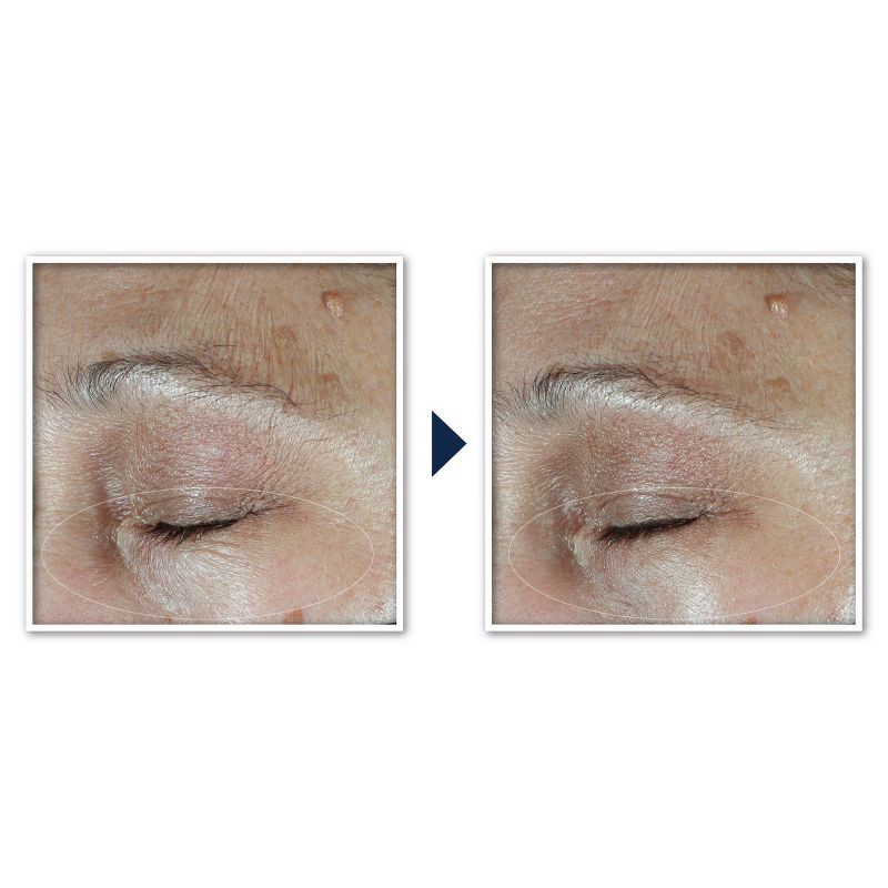 slide 8 of 13, RoC Multi Correxion Hydrate + Plump Eye Cream with Hyaluronic Acid - 0.5oz, 0.5 oz