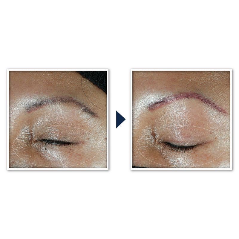 slide 3 of 13, RoC Multi Correxion Hydrate + Plump Eye Cream with Hyaluronic Acid - 0.5oz, 0.5 oz