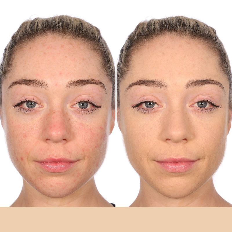 slide 4 of 8, Almay Clear Complexion Foundation - 200 Buff - 1 fl oz, 1 fl oz