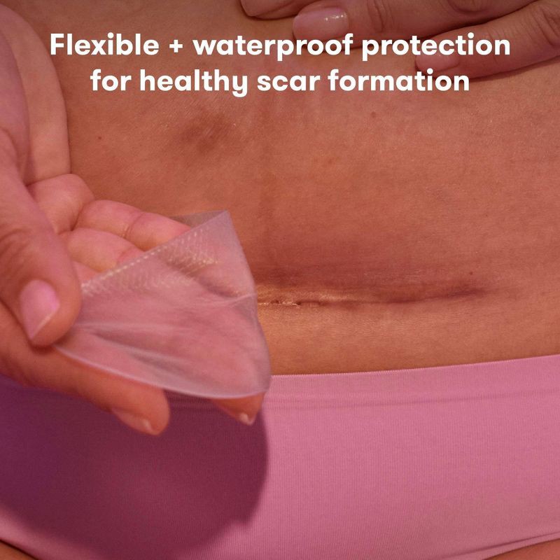 slide 2 of 6, Frida Mom C-Section Silicone Scar Patches, 1 ct