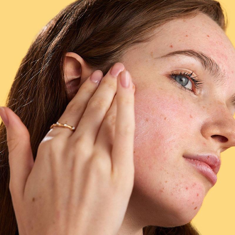 slide 3 of 7, ZitSticka Megashade Breakout-Proof Face Serum - SPF 50 - 1.01 fl oz, 0 x 1.01 fl oz