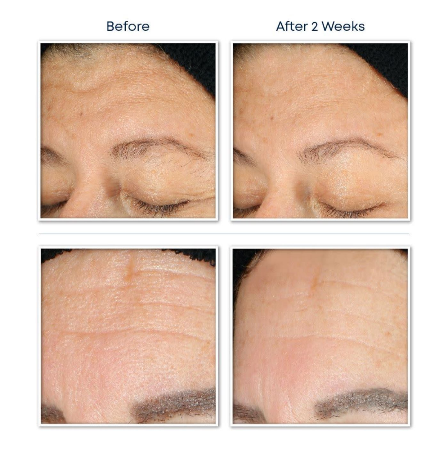 slide 2 of 4, Roc Multi Correxion Revive + Glow Gel Cleanser, 6 oz