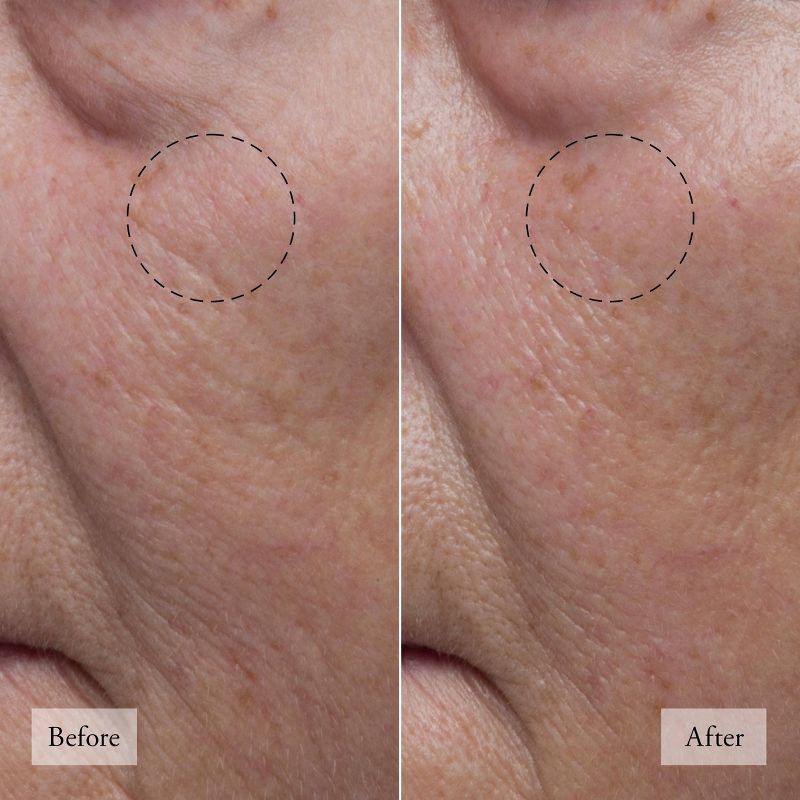 slide 4 of 8, philosophy Hope In A Jar Water Cream Hyaluronic Glow Moisturizer - 2 fl oz - Ulta Beauty, 2 fl oz