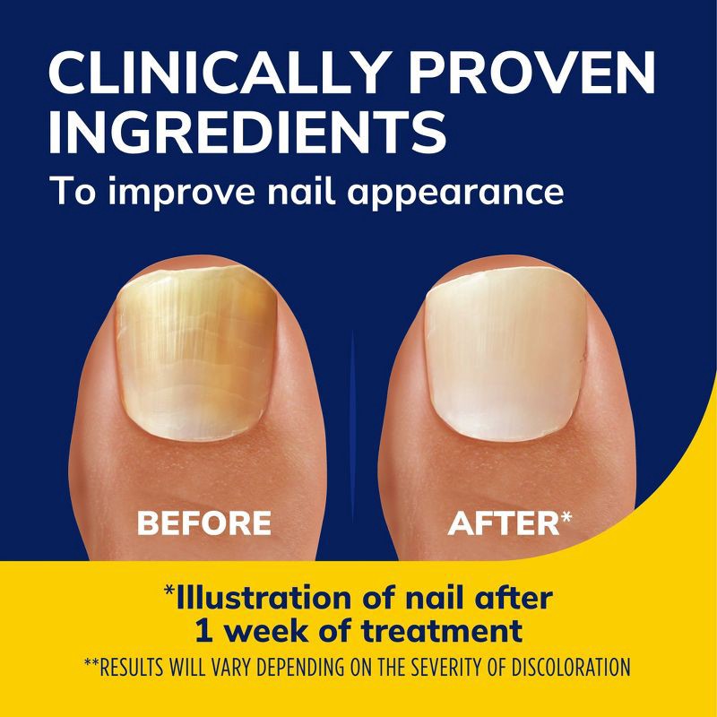 slide 7 of 9, Dr. Scholl's Fungal Nail Treatment and Revitalizer, LED Light Therapy - 0.33 fl oz, 0.33 fl oz