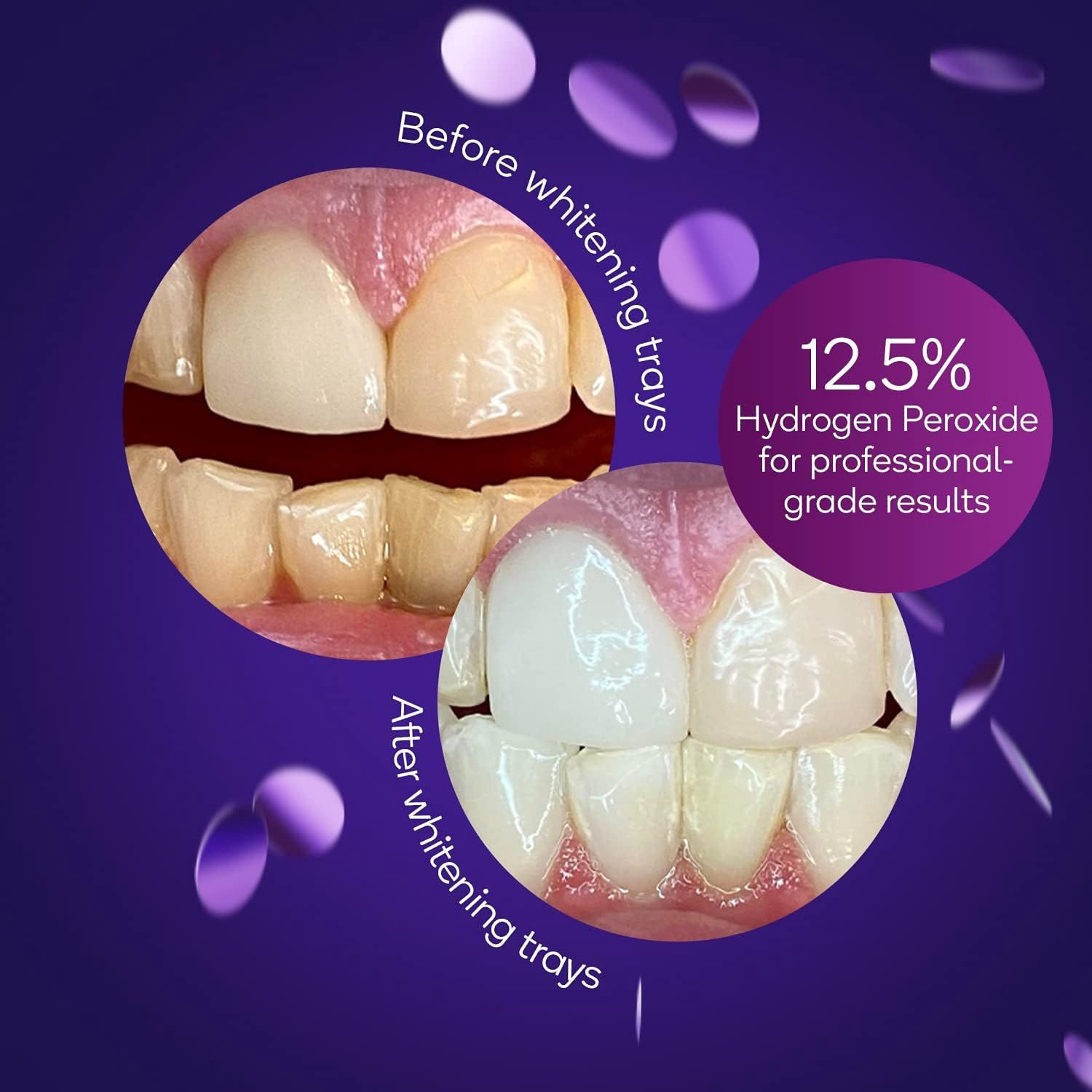 slide 2 of 6, Burst Prefilled Fresh Mint Whitening Trays 6 ea, 6 ct