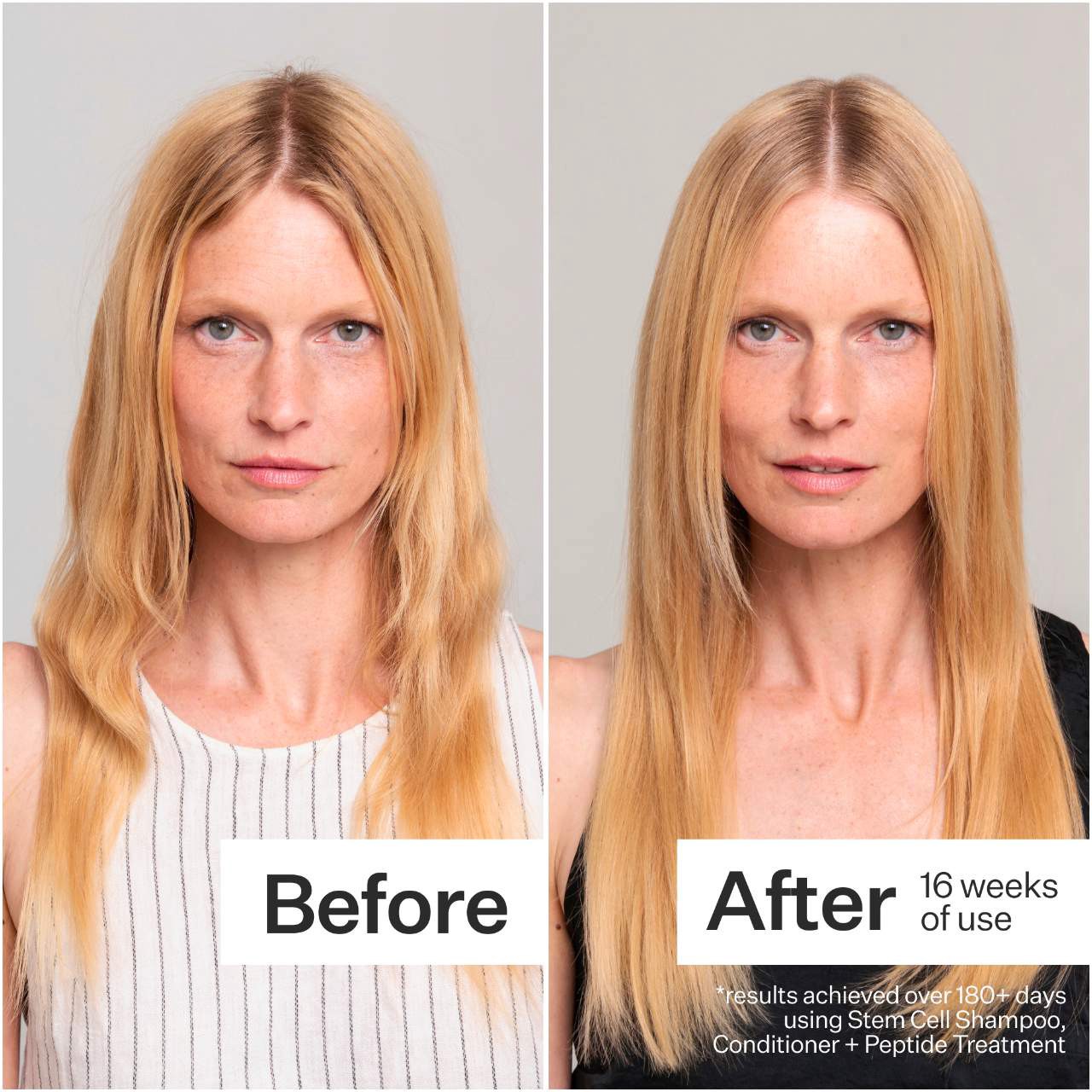 slide 2 of 9, Act+Acre Stem Cell Shampoo For Thicker+ Fuller-Looking Hair 10 oz, 10 oz