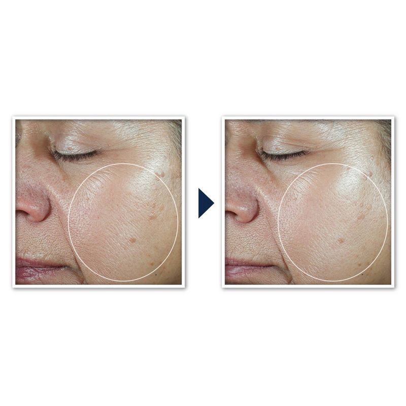 slide 8 of 8, RoC Multi Correxion Even Tone + Lift 5-in-1 Daily Moisturizer - SPF 30 - 1.7oz, 30 ct; 1.7 oz