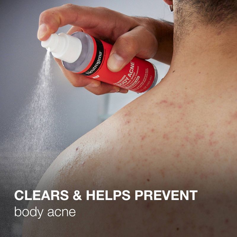 slide 3 of 7, Neutrogena Stubborn Body Acne Treatment Spray with Salicylic Acid - 5.5 oz, 5.5 oz