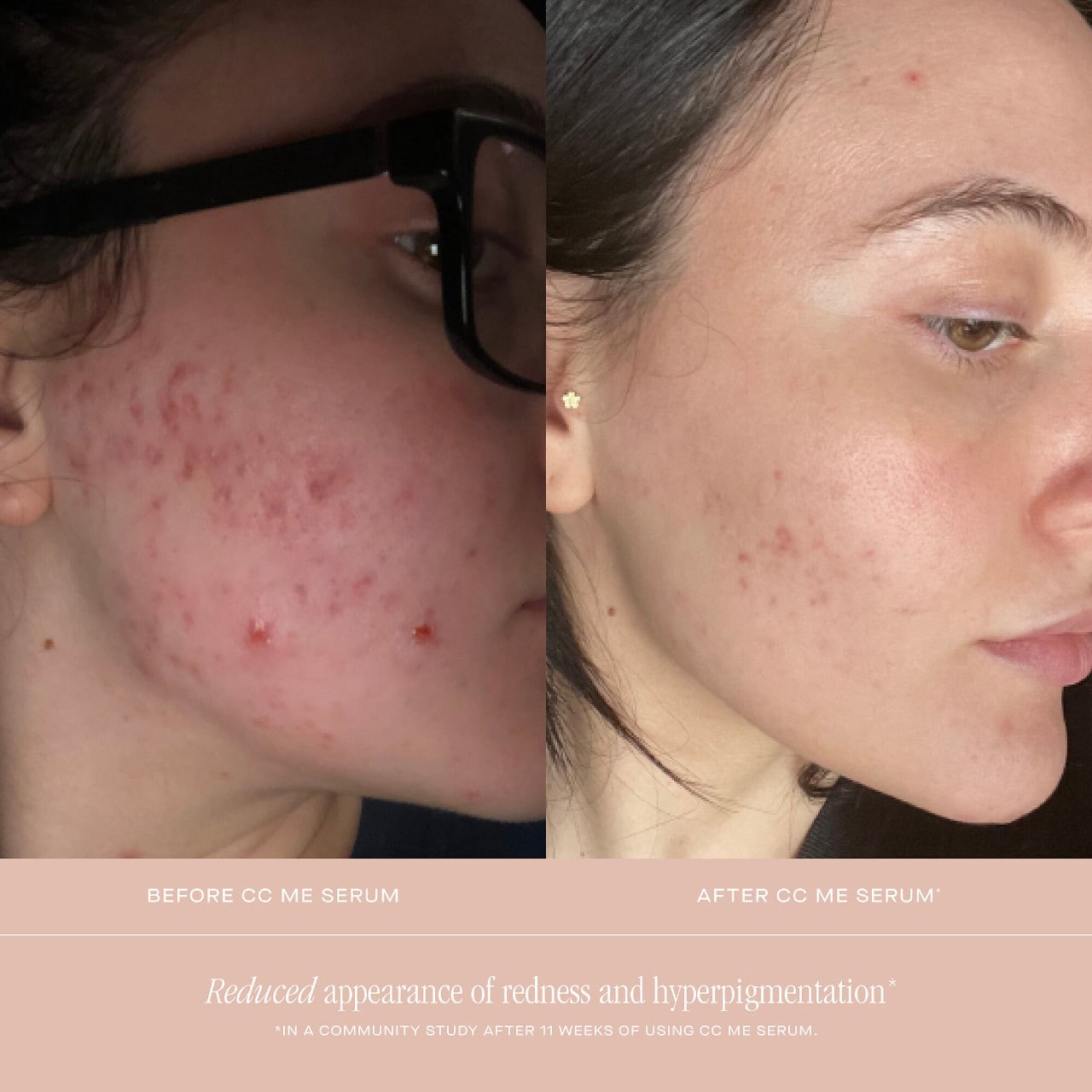 slide 4 of 9, Summer Fridays CC Me Vitamin C + Niacinamide Serum 1.0 oz/ 30 mL, 1 oz/ 30 ml