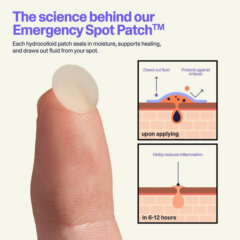 slide 10 of 12, Curology Emergency Spot Facial Pimple Patches - 40ct, 40 ct