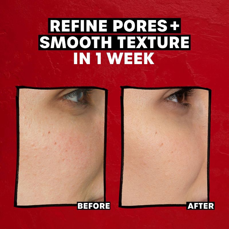 slide 5 of 9, Thayers Natural Remedies 2% AHA Exfoliating Toner - 12 fl oz, 12 fl oz